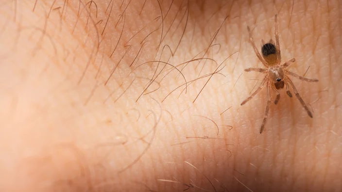 Symptoms of an American House Spider Bite